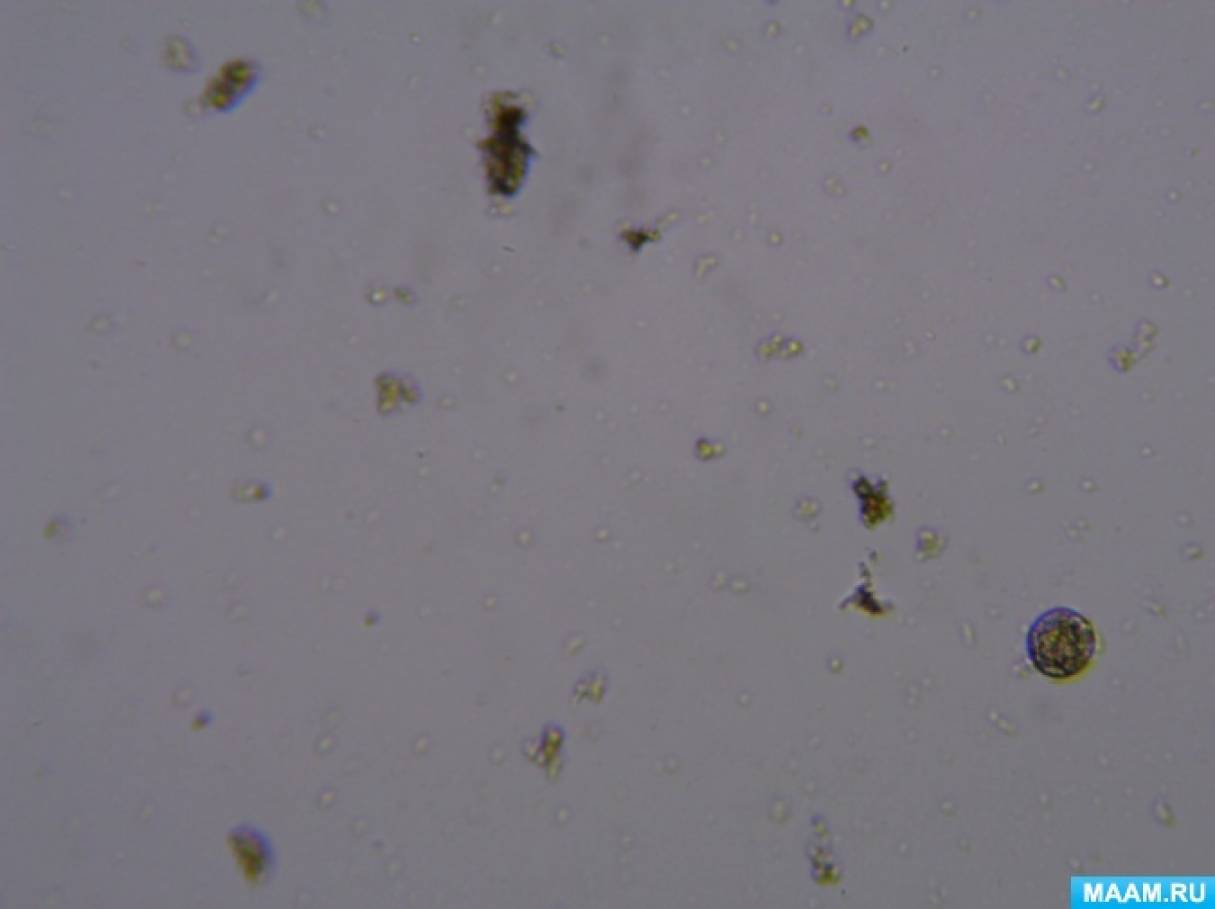 Коронавирус под микроскопом (фотогалерея)
